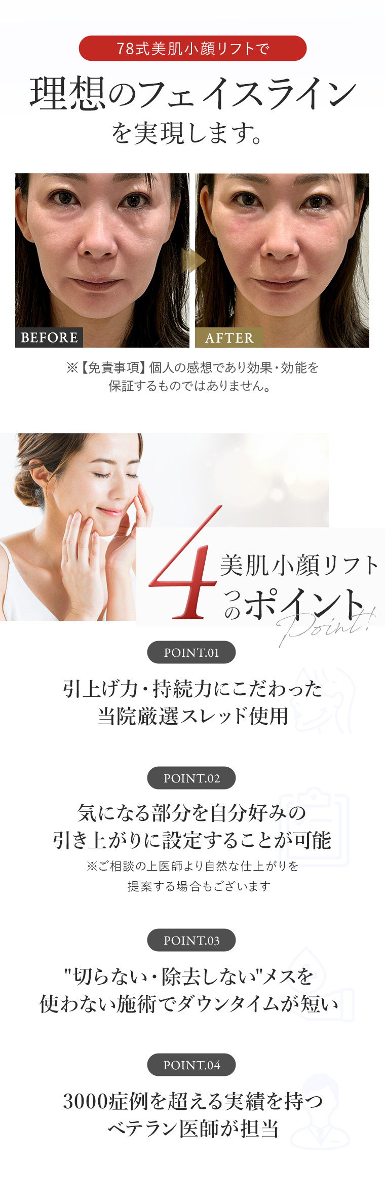 78式小顔美肌リフトはたった30分でたるみのない理想のフェイスラインを実現します。78式美肌小顔リフト4ポイント 的確な提案と技術 即効性と自然な仕上がり 若々しい美肌に導く ダウンタイムが短い
